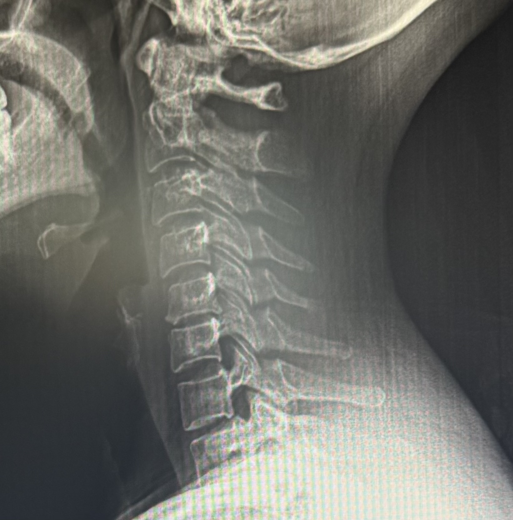 X-rays Scottsdale - Hudson Chiropractic - Dr. Shaun Hudson in